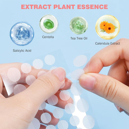 Pimple Patches for Face 207PCS, Hydrocolloid Acne Patches for Covering Zits and Blemishes, Cute Star Pimple Patches, Facial Skin Care Products.